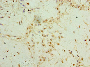 TET2 Antibody
