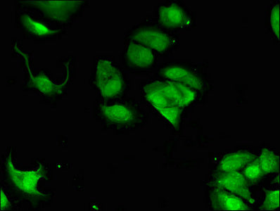 LLGL2 Antibody