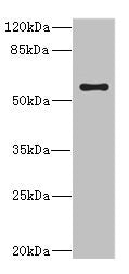CYP4V2 Antibody
