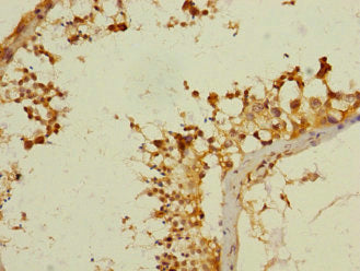 ANKS1B Antibody