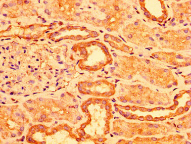 ACOT1 Antibody