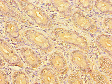 SLC51A Antibody