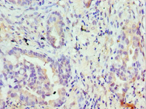 TRPM8 Antibody