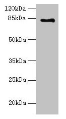 LCA5 Antibody