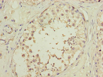 OOSP2 Antibody