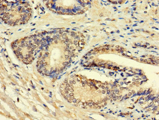 HSD11B1L Antibody