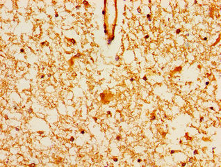 MAGI2 Antibody