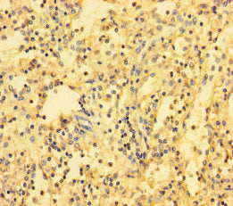ABI3BP Antibody