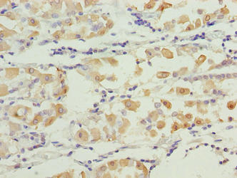 SMG6 Antibody