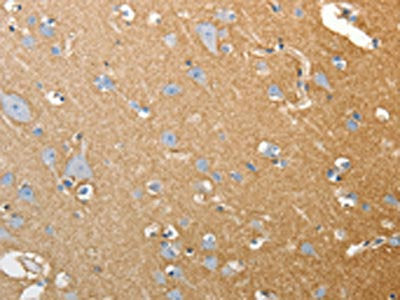 SLC4A4 Antibody