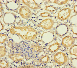 MRPL21 Antibody