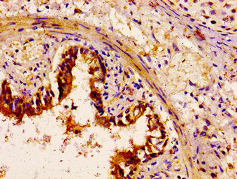 MYH14 Antibody