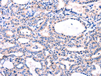 DUSP12 Antibody