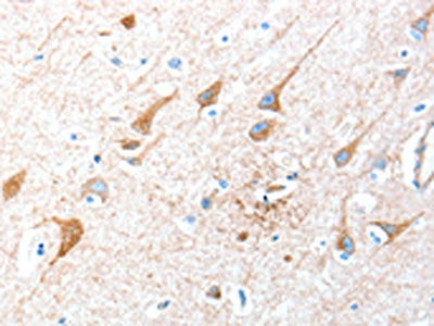 AKT3 Antibody
