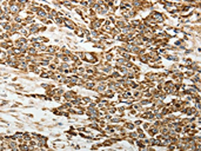 SELE Antibody