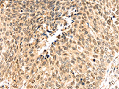 PSMB8 Antibody