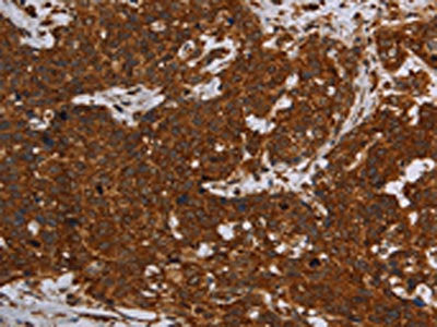 ERRFI1 Antibody