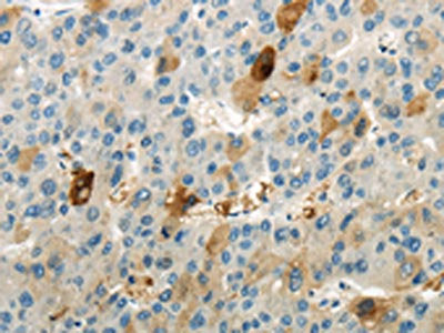 WNK1 Antibody