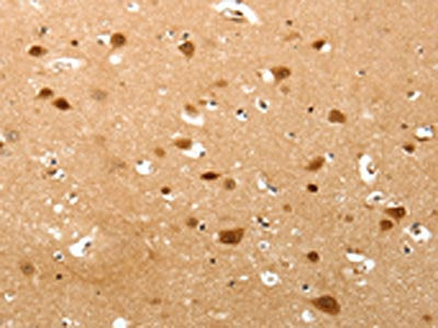 TNN Antibody