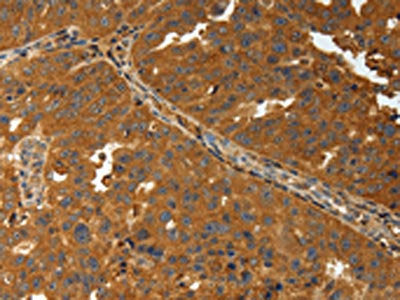 AMD1 Antibody