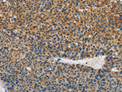 SGK1 Antibody