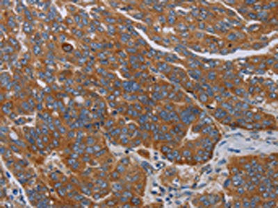 PARP10 Antibody