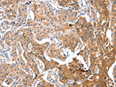 ADA Antibody