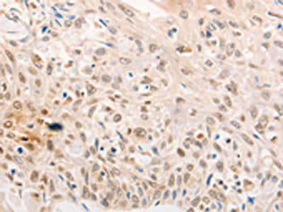 NOX4 Antibody