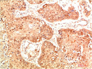NFE2L2 Antibody