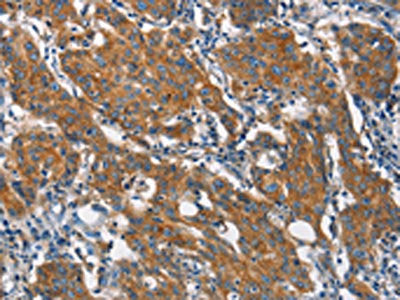 CLTC Antibody