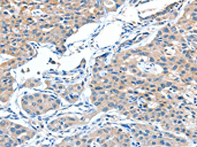 ADAMTSL1 Antibody