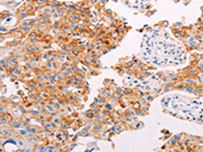 PLIN2 Antibody