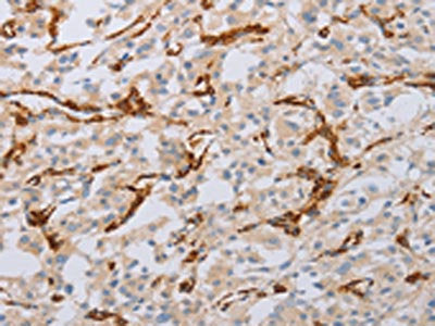 MYL6 Antibody