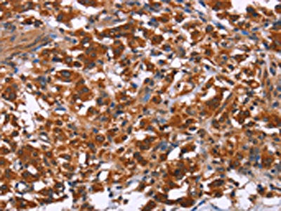 ING2 Antibody