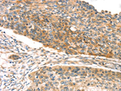 TPST1 Antibody