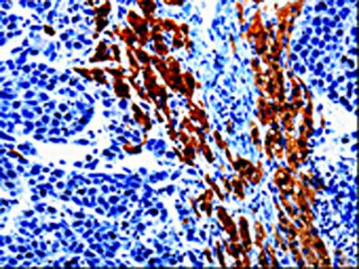 EPHX1 Antibody