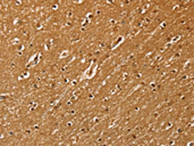 SSX2 Antibody