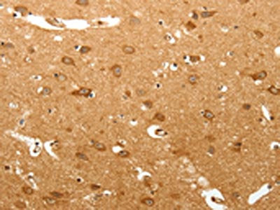 MAP1B Antibody