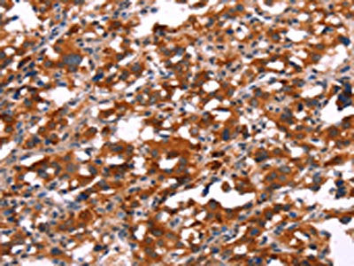 SLC6A1 Antibody