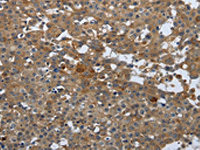 PGR Antibody