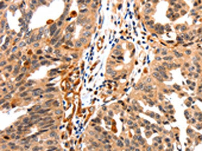 GAS6 Antibody