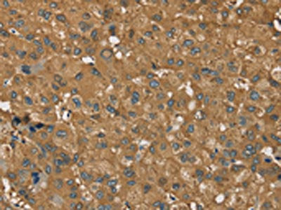 RORB Antibody