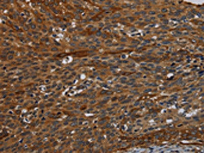 IVL Antibody