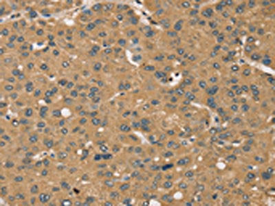 KDM5A Antibody