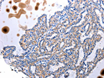 UTS2 Antibody