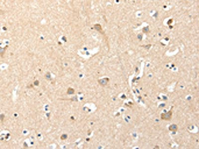 RRAD Antibody