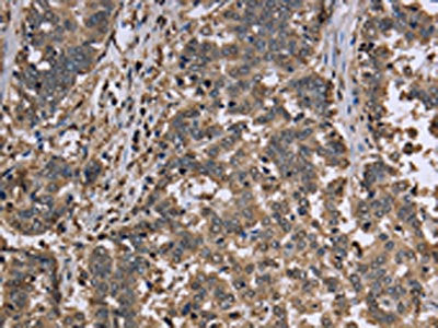 GAPDH Antibody