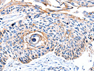 CCNB2 Antibody