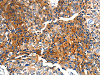 MTNR1A Antibody