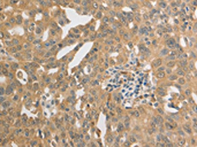 PRDX1 Antibody